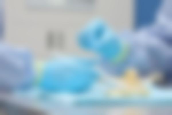 薛轶群医生整形价格贵不贵？