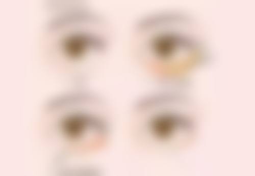 【祁爱琳医生口碑】