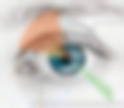 黔东南爱尔眼科医院的口碑评价：患者心中的好医院