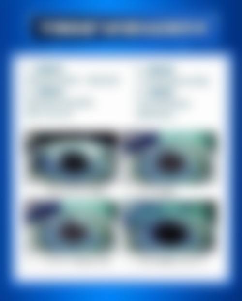 黔东南爱尔眼科医院医保能报销吗？能！8730元起享专业眼科项目，快拨打电话咨询吧！ 