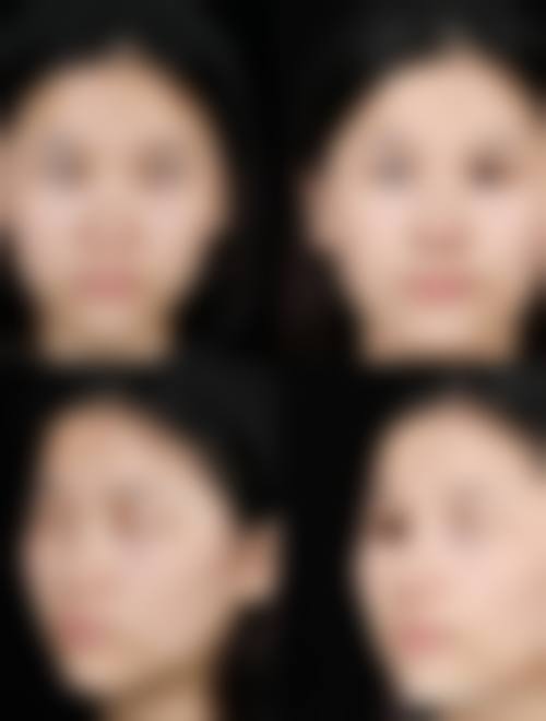 分享我在成都青羊雅肤媛找卢帆做鼻整形的经历，术后鼻子超自然，拍照都变上镜了！ 