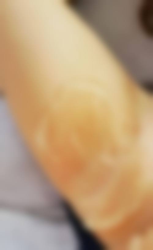 大连爱德丽格医美开展该项目的优势