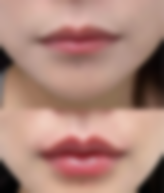 八、政策与保险理赔