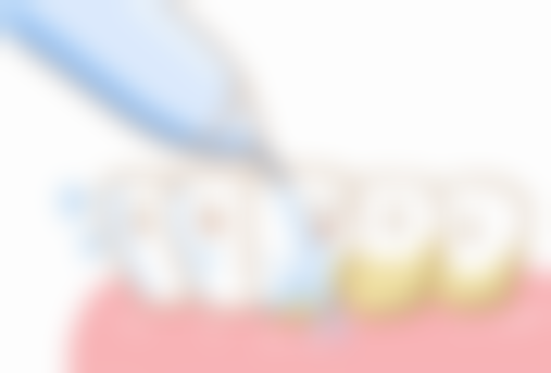 【济宁正博口腔门诊部参考价格表：】