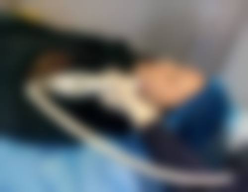 VISIA皮肤检测项目的技术优势