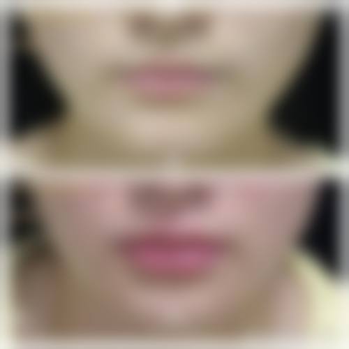 【昆明时光医学美容门诊部(原拉雅)患者口碑评价:】