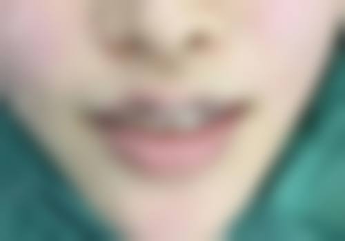 【安顺市人民医院整形美容科诊疗设备:】