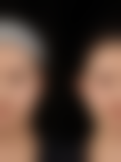 【昆明时光医学美容门诊部(原拉雅)参考价格表:】