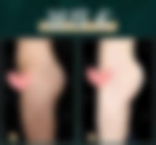 【广州高尚医学美容中 心患者口碑评价：】