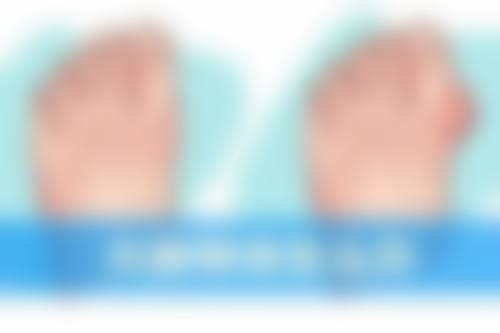 瘦脸针哪里打比较正规