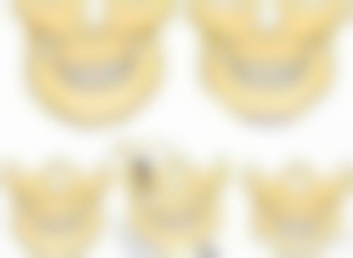 瘦脸针一般打几次定型