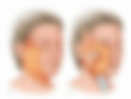 头发种植成活率