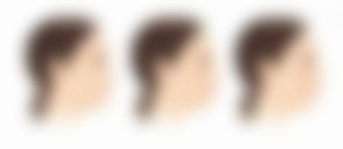 下嘴唇加厚手术