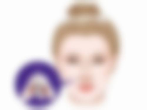 下嘴唇厚做什么手术