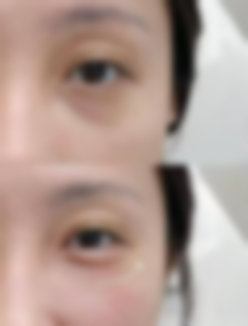 下唇厚可以整吗