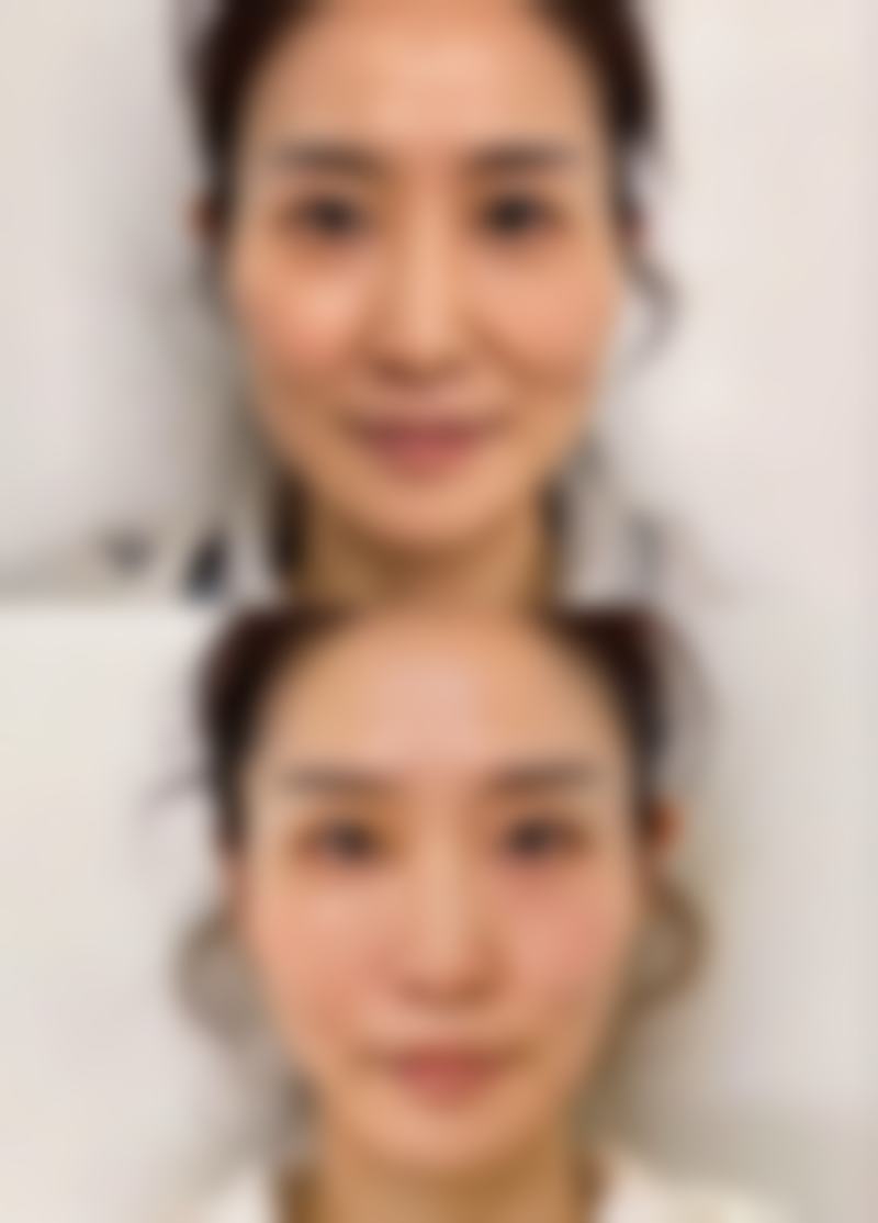 穴位与丰太阳穴危险的关联