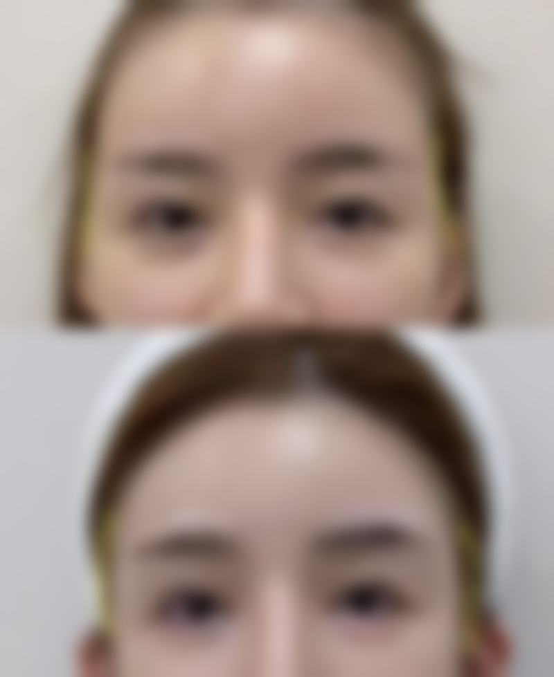 种植视频全过程