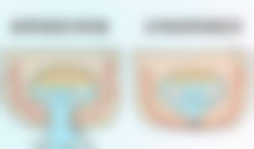 什么牌子的玻尿酸更好