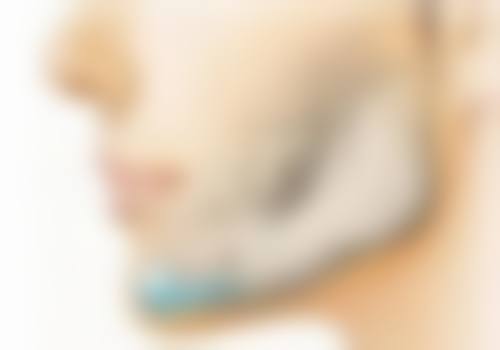 头上疤痕可以种发吗