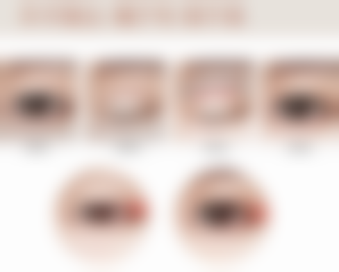 思嘉丽丽美玻尿酸