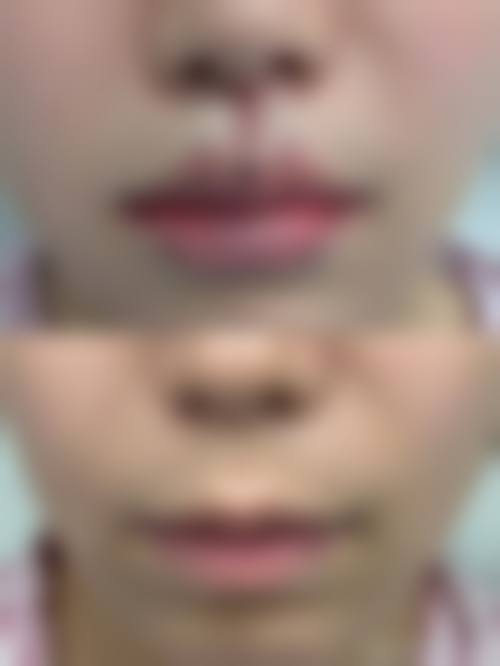 【乌鲁木齐阐艺美医疗美容门诊部患者口碑评价:】