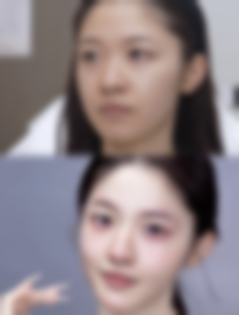 做阴道紧缩术的好处