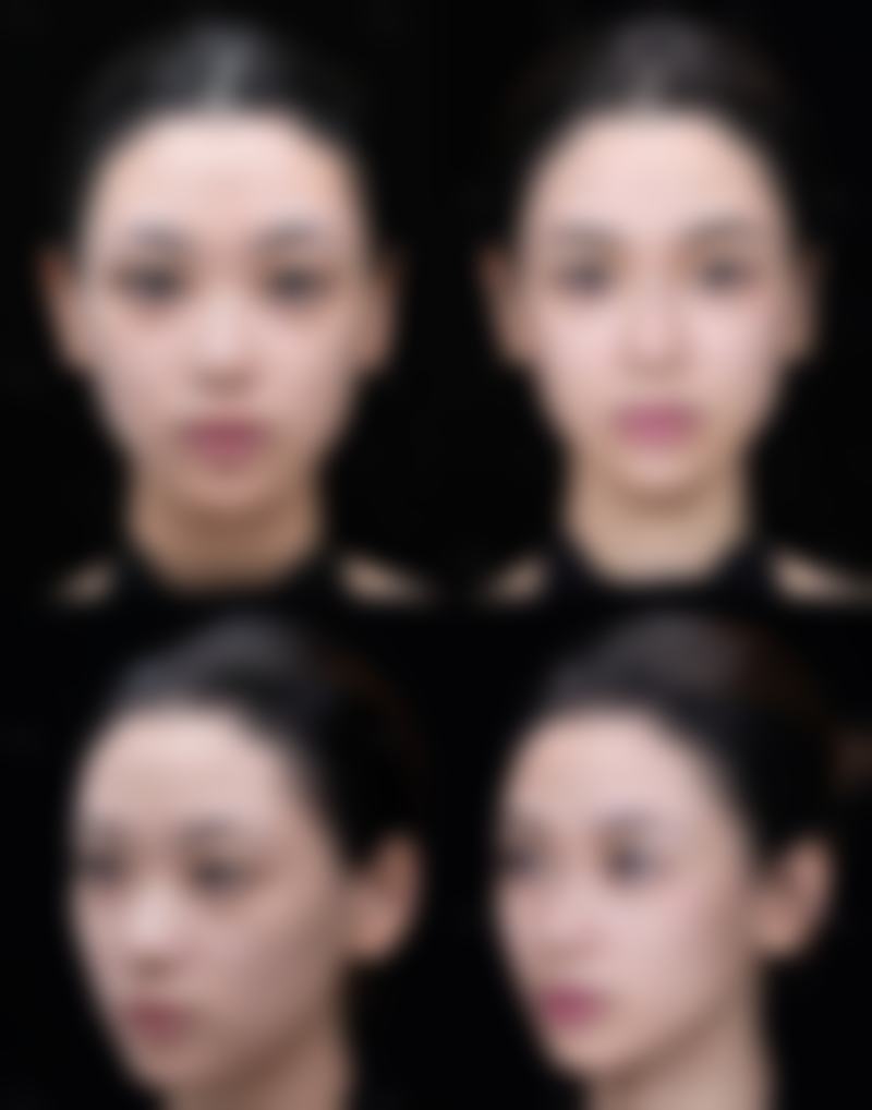 【青岛韩艺美整形医院怎么预约挂号?】