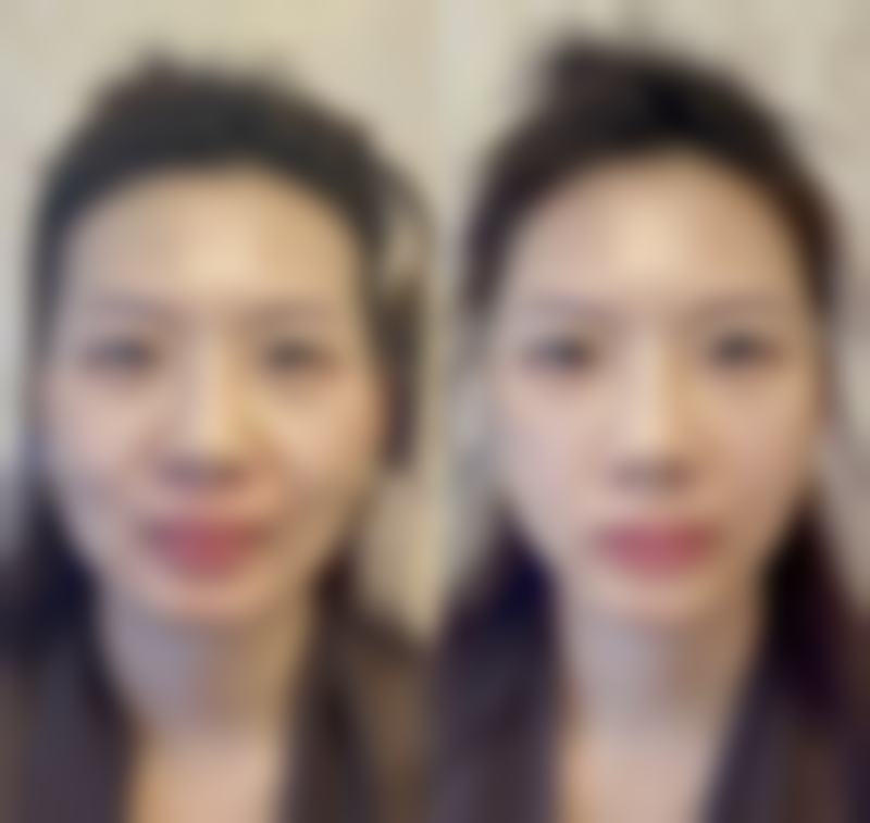 【深圳肌本分析医疗美容诊所患者口碑评价:】