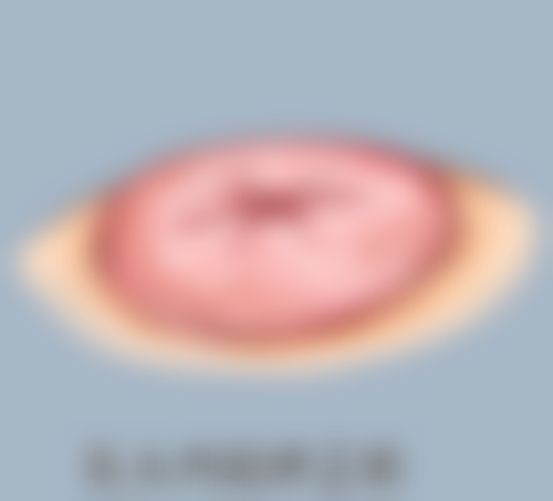 瘦脸针多久更明显