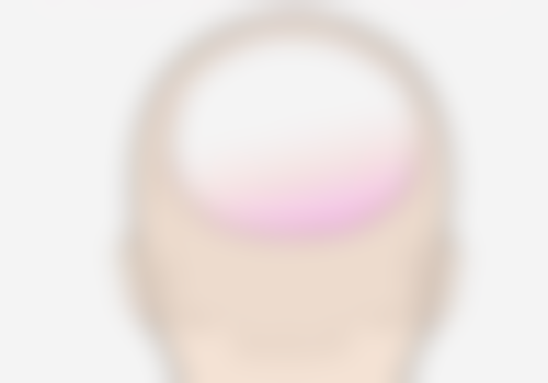 瘦脸针能立马见效吗？揭秘3种常见类型瘦脸针生效时间，选对它一周就能让你脸瘦一圈！ 