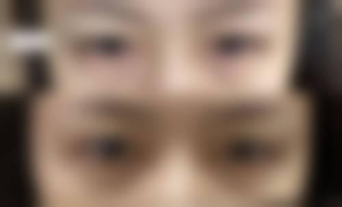 丰太阳穴方法价格对比