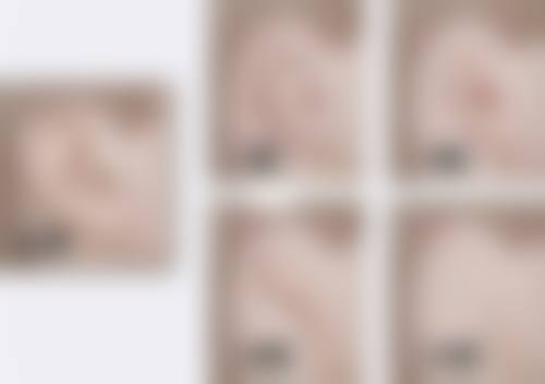 瘦脸针打完多久见效?