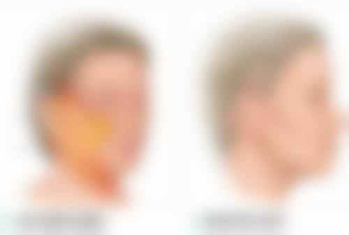 毛发种植危害有哪些？揭秘3大潜在风险，更有5大科学应对策略让你安心变美！ 