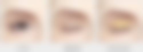 其他快速除皱方法