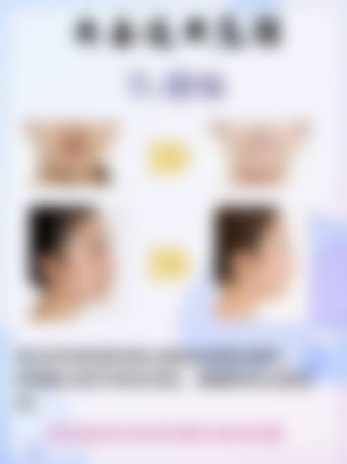 瘦脸针多久可以修复原来的样子