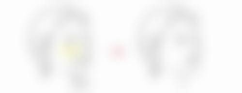 拉皮除皱百科:什么是拉皮手术?