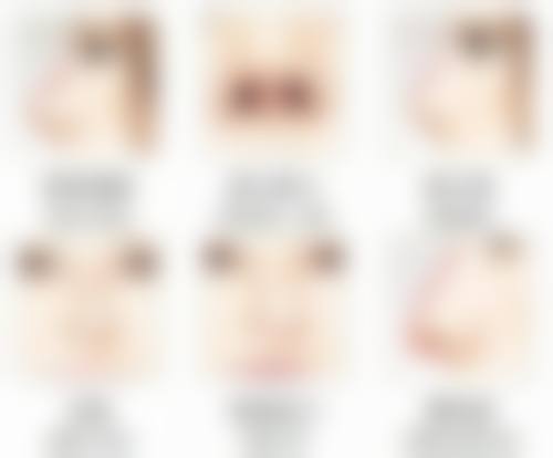 怎样可以迅速除皱呢？医美揭秘：3大快速除皱方法，让你5天淡化皱纹，重拾年轻光彩！ 