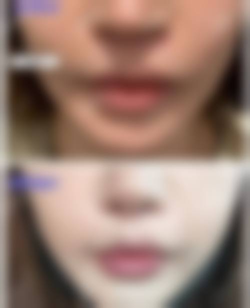 【烟台德华美容外科整形诊所参考价格表：】