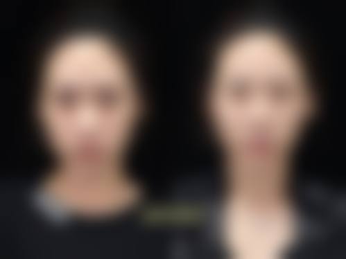 【宁夏慧清雅妍医疗美容怎么预约挂号?】