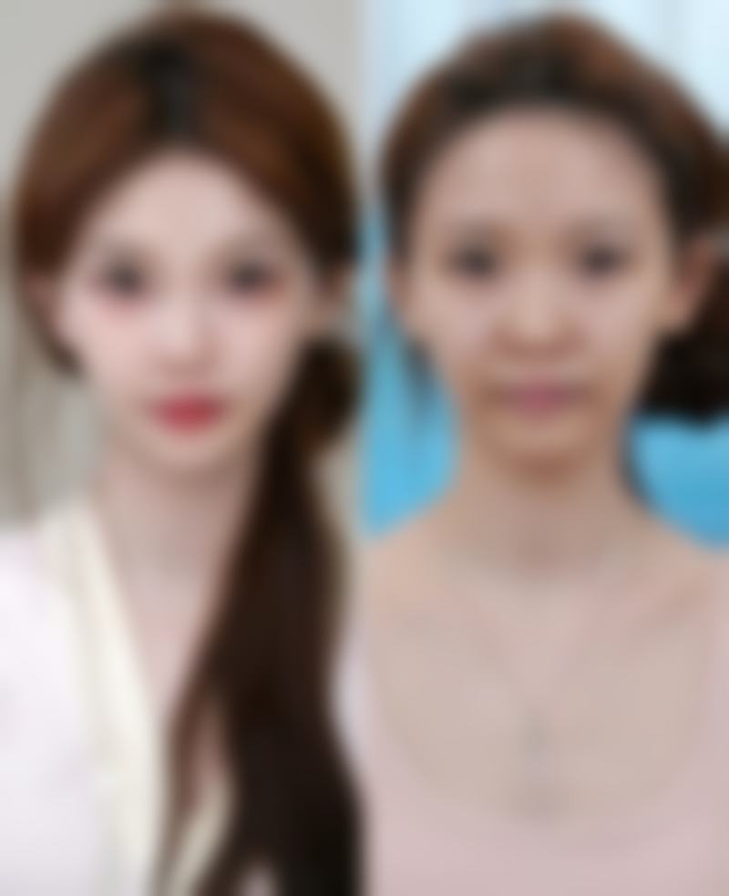 【深圳素仁整形医院诊疗设备:】