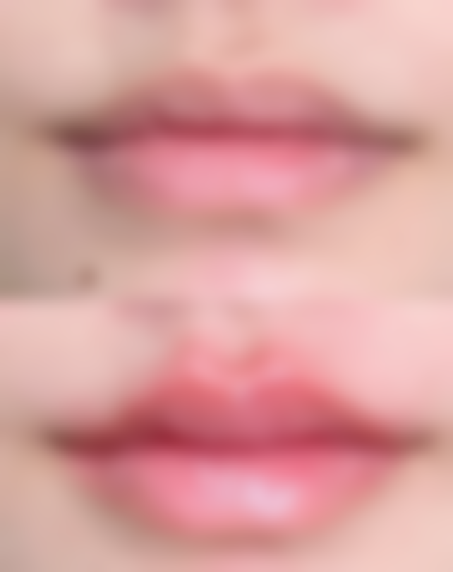 毛发种植有什么副作用