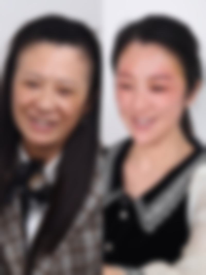 瘦脸针一般打50单位还是100单位?