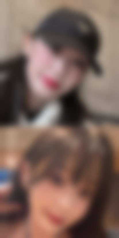 种植头发夏天好还是冬天好