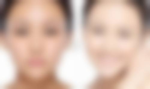 瘦脸针打完多久见效