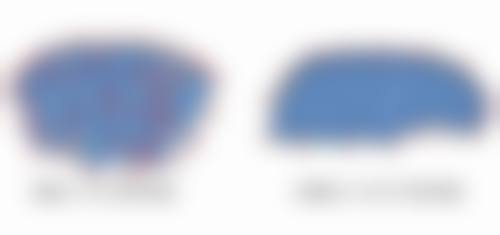 打瘦脸针脸歪了还能修复吗