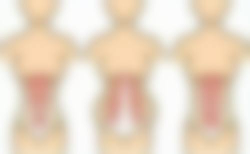 做阴道紧缩术有没有后遗症