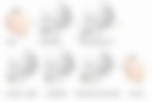 做阴道紧缩术有危险吗