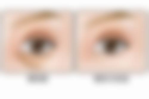 瘦脸针打几次就恒久了