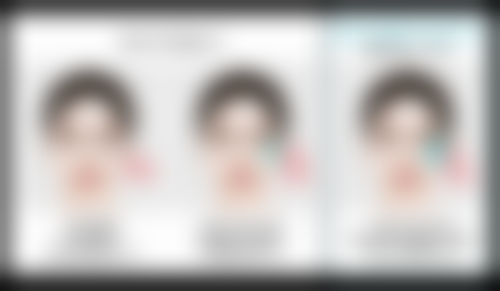 做阴道紧缩术需要休息多久