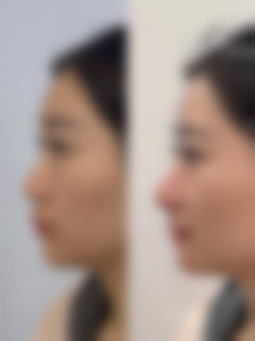 【丹东市第一医院国内外医疗部医学美容整形中 心地址：】